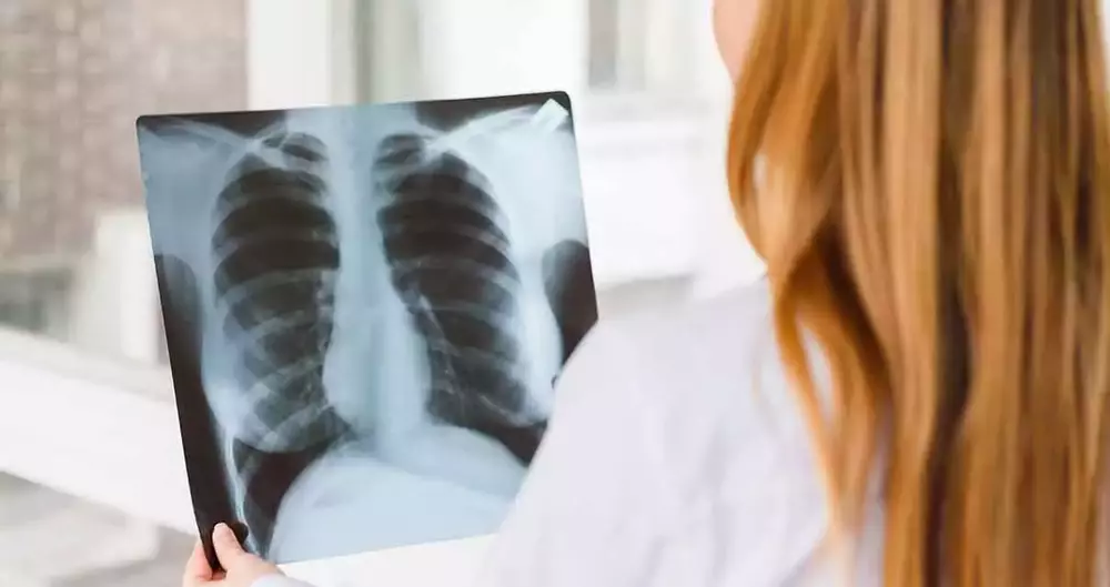 The Queens Mesothelioma Lawyers at